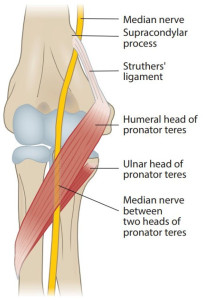 1200px-Anatomy_of_the_median_nerve_at_the_pronator_teres