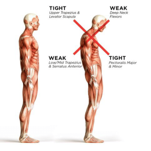 posture-comparison