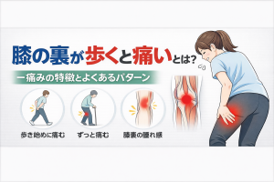 膝の裏 歩くと痛い時の原因と対処法｜症状・ストレッチ・病気チェックガイド | 札幌市東区の整体なら「足うら屋」